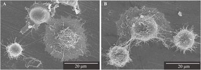 Investigation of a new implant surface modification using phosphorylated pullulan